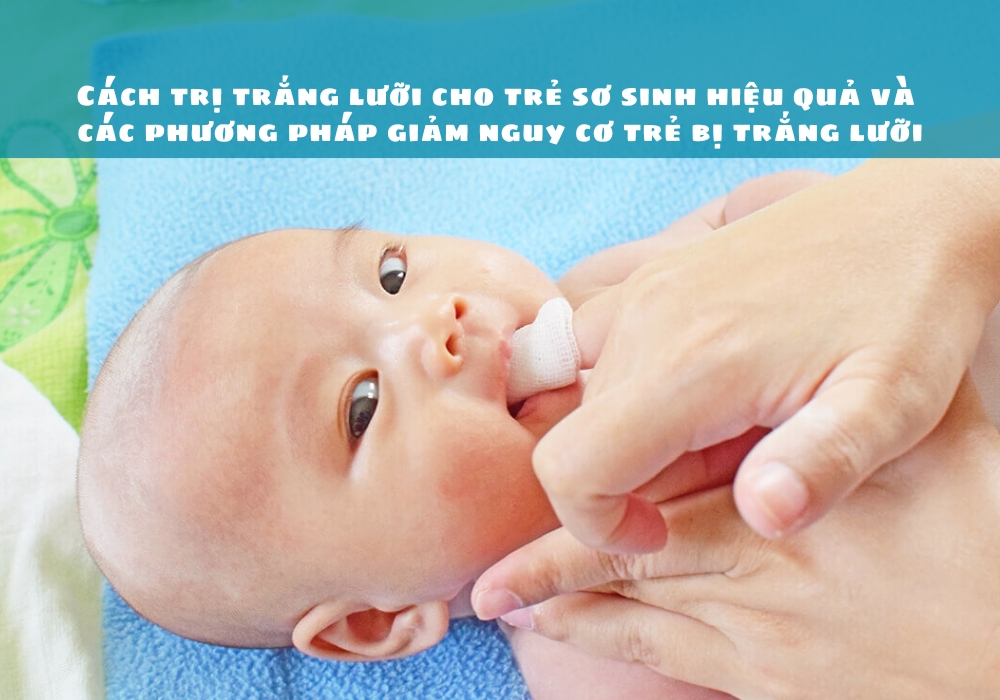 Cách trị trắng lưỡi cho trẻ sơ sinh hiệu quả và các phương pháp giảm nguy cơ trẻ bị trắng lưỡi 9