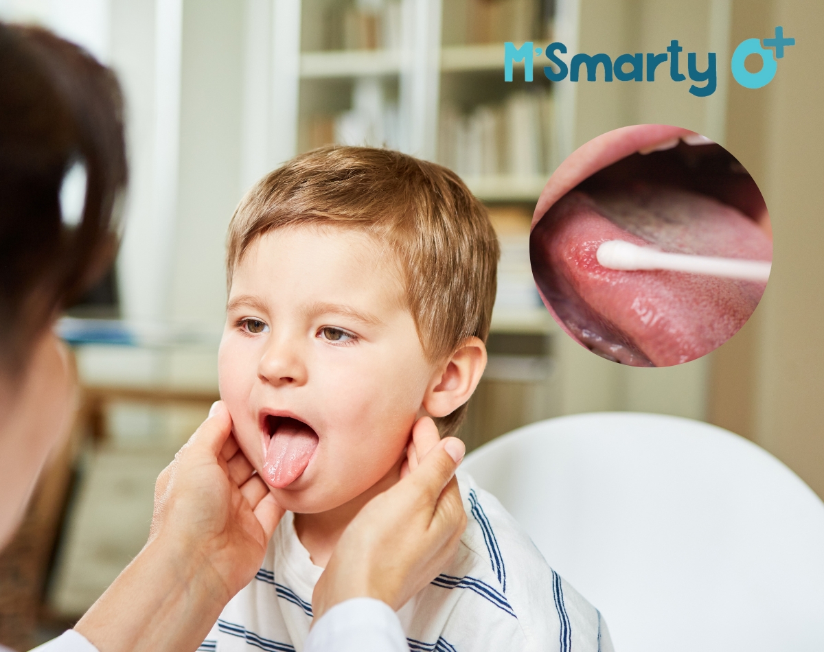 Các bệnh về lưỡi ở trẻ em mà mẹ cần biết 2