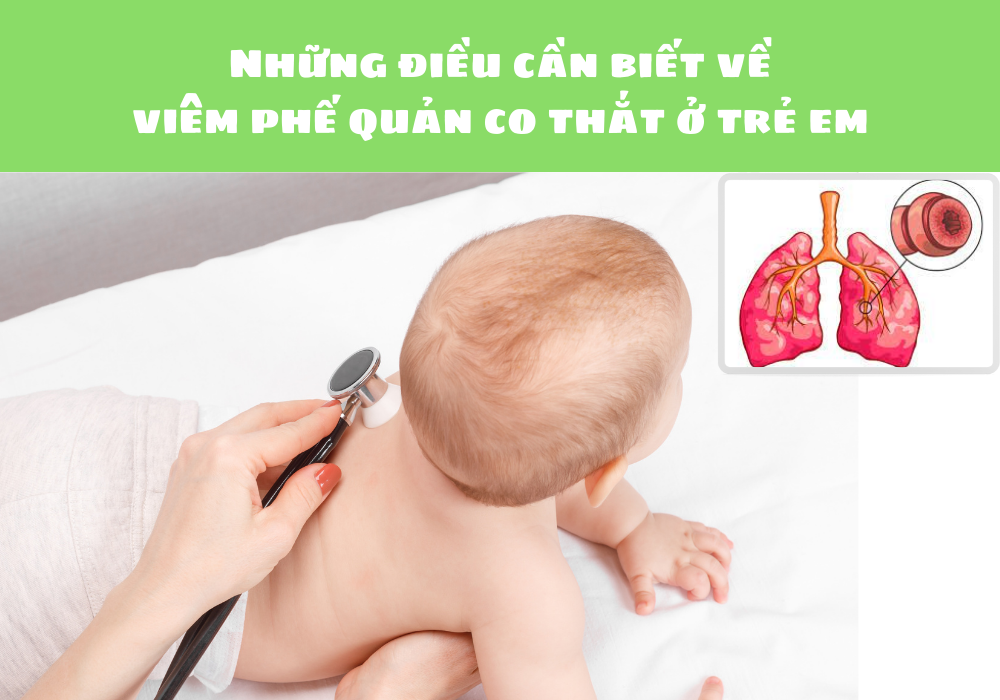 Những điều cần biết về viêm phế quản co thắt ở trẻ em